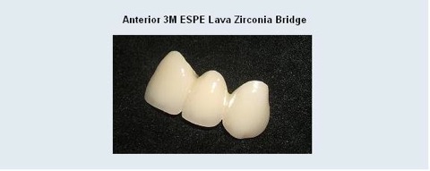 Zirconia_4.JPG
