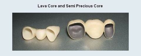 Zirconia_comparison.JPG